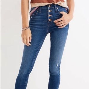 Madewell 10” high rise skinny in dark wash